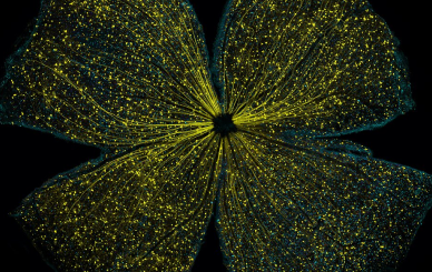 Bright yellow cells in a flower formation against a black background 